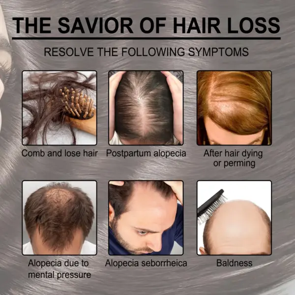 Serum pour les cheveux romarin – Image 5