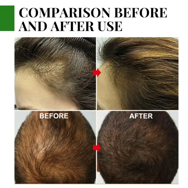 Serum pour les cheveux romarin – Image 4