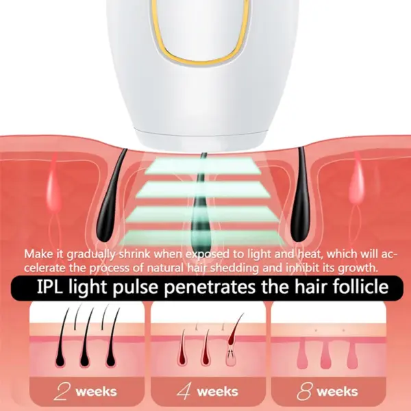 Épilateur laser professionnel IPL – Épilation durable à domicile – Image 6